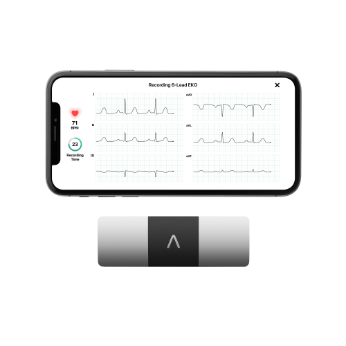 AliveCor KardiaMobile ECG mobile 6L