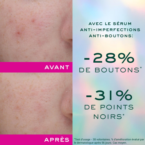 Zinc Power Sérum anti-imperfections anti-boutons 30 mL