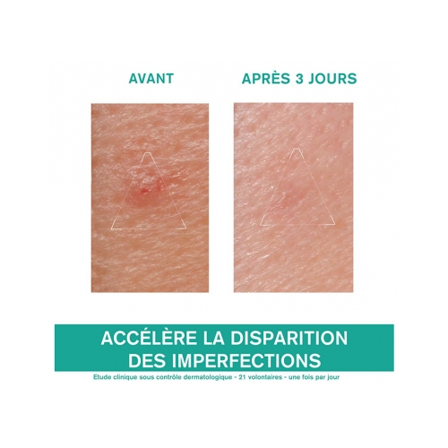 Hyséac Pâte SOS Soin Local 15 g