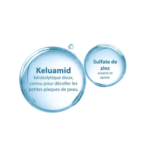 Squanorm Démangeaisons Liées Aux Pellicules 200 ml