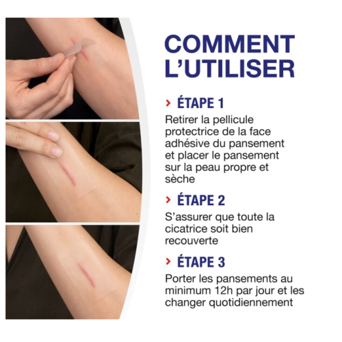Réducteur de cicatrices 21 pansements