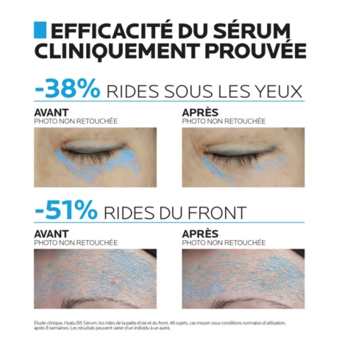 Hyalu B5 Sérum Concentré Anti-Rides Réparateur Repulpant 50 ml + Sérum Yeux 5 ml Offert