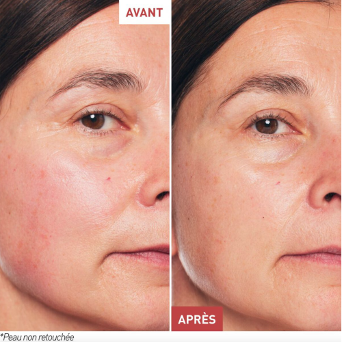 Skin Therapy Huile de Nuit Multi-Perfectrice 30 ml