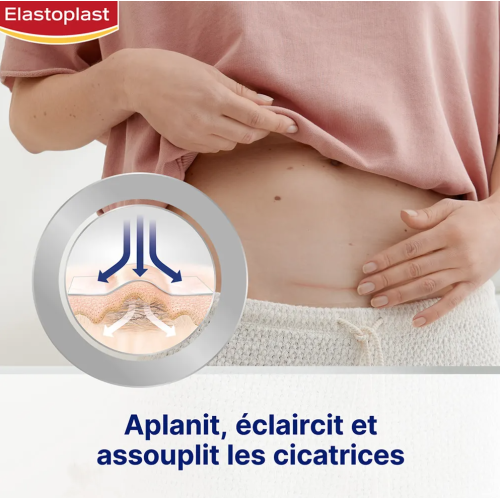Réducteur de Cicatrices XL 21 Pansements Transparents