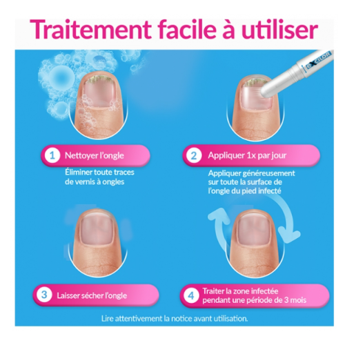Easy Traitement Mycose de l'Ongle Déjaunissement Actif 4 ml