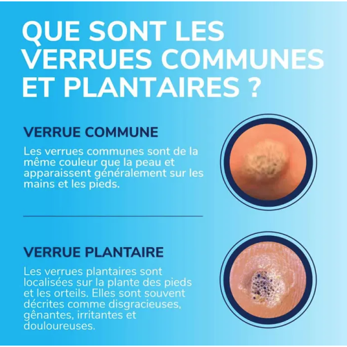 Traitement Verrues Pieds & Mains 35 ml