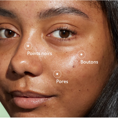 Vinopure Sérum Salicylique Anti-Imperfections 30 ml