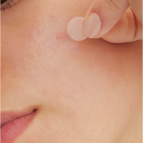 Patchs Anti-Imperfections 22 patchs