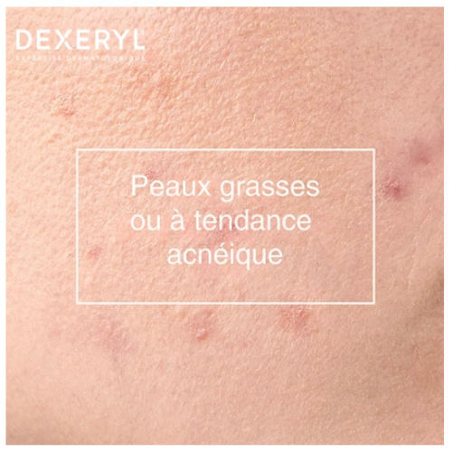 Dexeryl Dexeclear Gel Moussant Anti-Imperfections 400 ml Dexeryl Dexeclear Gel Moussant Anti-Imperfections 400 ml