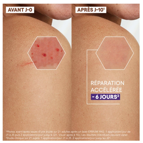 Epitheliale A.H Ultra Repair Crème Réparatrice Anti-Marques 40 ml