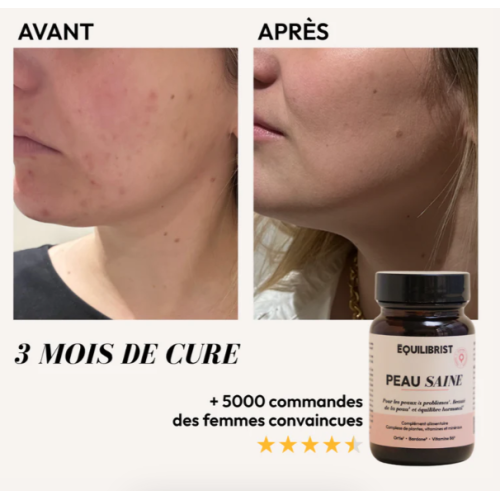 Opéka Peau Saine 30 gélules