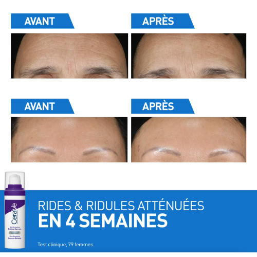 Skin Renewing Sérum Rétinol 30 ml