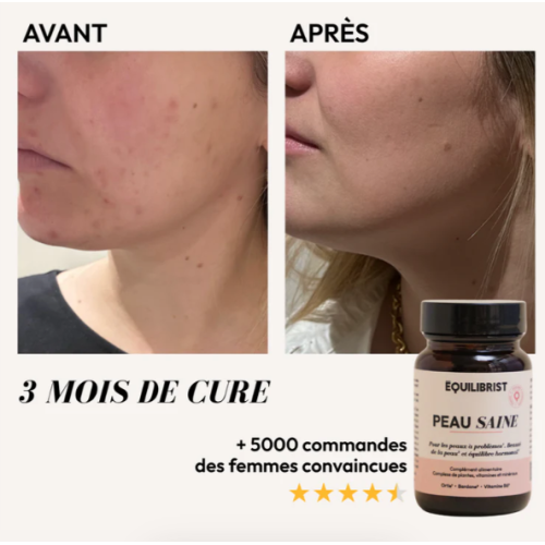 Peau Saine 30 gélules