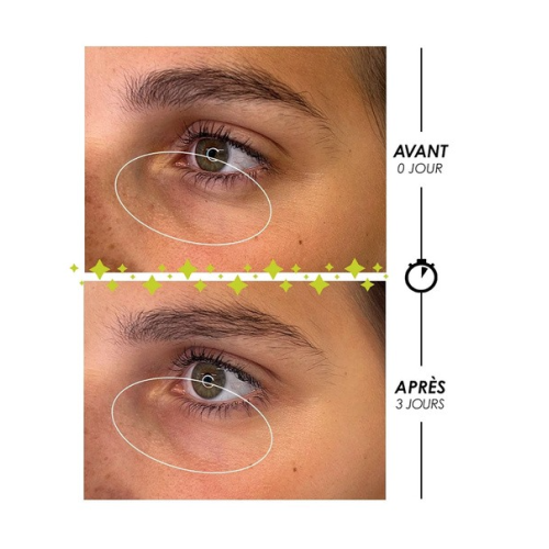 Larmes de Fantôme 10 ml + 2 Patchs Yeux en Silicone Réutilisables Offert