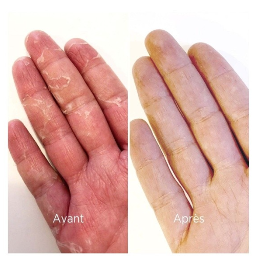 Gants Réutilisables Booster d'Hydratation 1 paire