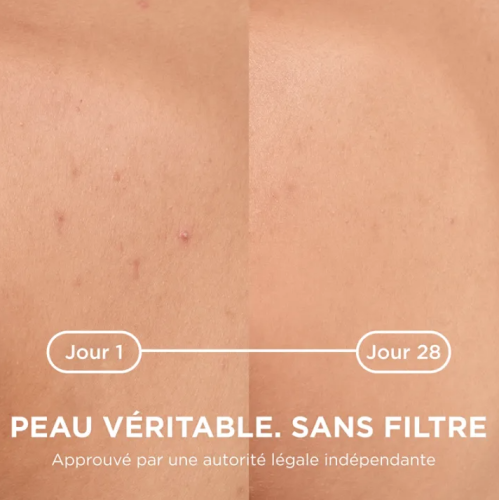 Sébium Kerato+ Body 150 ml