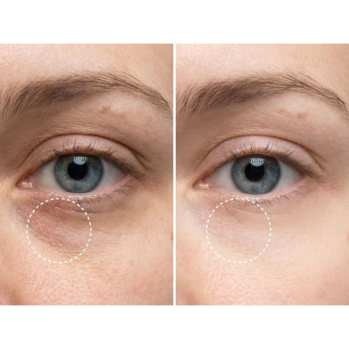 Patchs Anti-Cernes Aloe Paris : Hydratation Express en 15 min