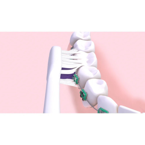 GUM Sonic Ortho : Brosse électrique pour brackets, nettoyage efficace