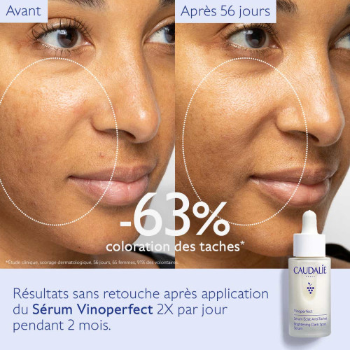 Vinoperfect Sérum Éclat Anti-Taches 30 ml