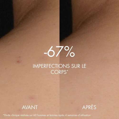 Biocorps Sérum Corps Peeling Peau Neuve 200 ml