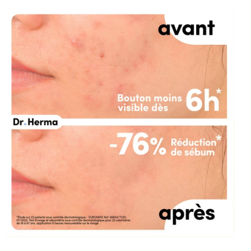 Dr Herma Patch Anti-Boutons 10 unités Peau saine et éclatante