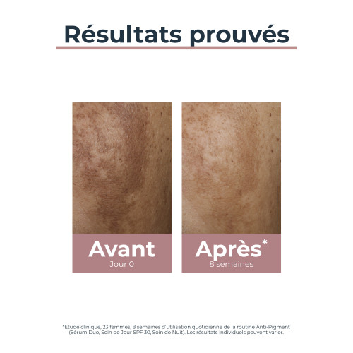 Eucerin Anti-Pigment Nuit 50ml - Unifie et Régénère la Peau