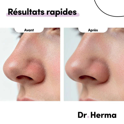 Dr Herma Patch Nez Anti-Points Noirs 5x2 Élimine et Hydrate - Pharma360