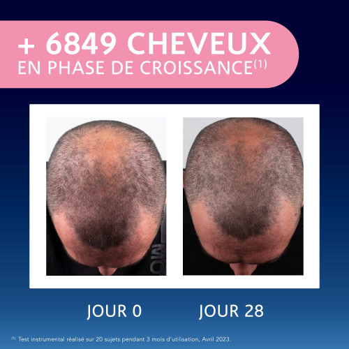 FORCAPIL - Elixir Croissance - Pousse & Fortifie Cheveux Clairsemés, 50ml