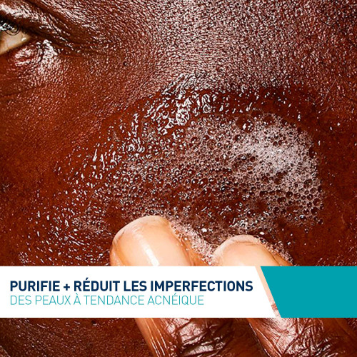 CeraVe Gel Moussant Anti-Imperfections 473ml Peau Nette Parapharmacie