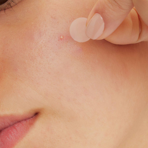 CeraVe Patchs Anti-Imperfections 22 patchs Peau nette et apaisée