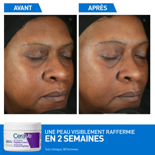 CeraVe Skin Renewing Crème Peptides 48g Anti-âge Hydratation Pharma360