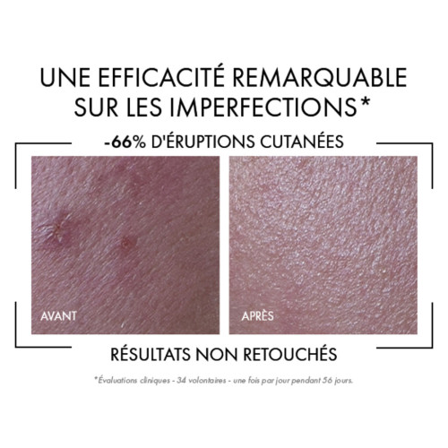Capital Soleil UV-Clear Fluide Anti-Imperfections SPF50+ 40 ml
