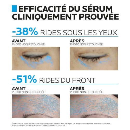 La Roche-Posay Hyalu B5 Sérum 50ml Anti-Rides Repulpant Pharma360