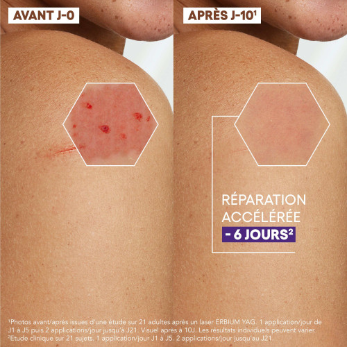 A-Derma Epitheliale A.H Ultra Repair Crème 100 ml Peau Réparée Rapidement