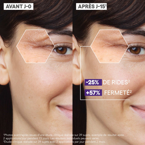 A-Derma Epitheliale A.H Ultra Repair Sérum 30ml Peau Lissée Pharma360