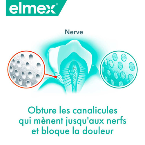 Elmex Sensitive Pro Blancheur 75ml - Protection et Éclat