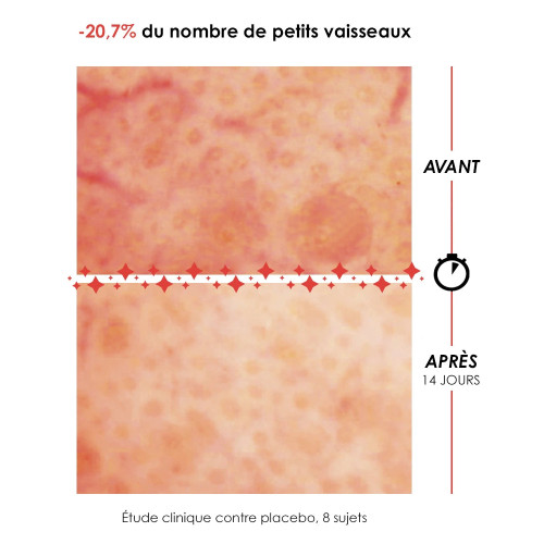 GARANCIA Sérum Anti-Rougeurs 30mL - Apaisant et Atténuateur