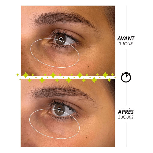 Garancia Larmes de Fantôme 10 ml Yeux Éclatants et Rajeunis Pharma360