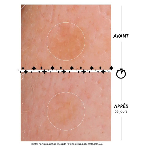 ECLAIR DE LUNE FOUDROYANTE : Coffret Anti-Taches SPF50+ Garancia