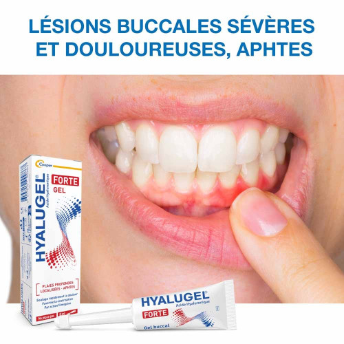 COOPER Forte Gel Buccal 8ml - Soulage et Cicatrise Rapidement