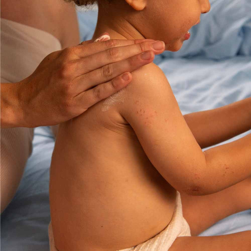 Mustela Stelatopia+ Crème Bio 300ml - Apaise et Hydrate