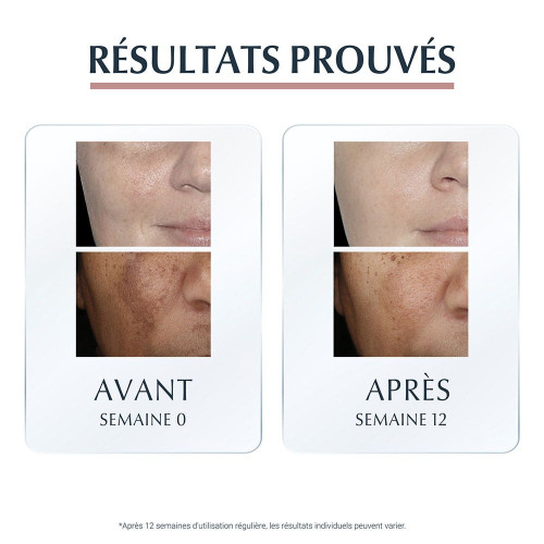Eucerin Sérum Duo Anti-Pigment 30ml - Réduit Taches Brunes