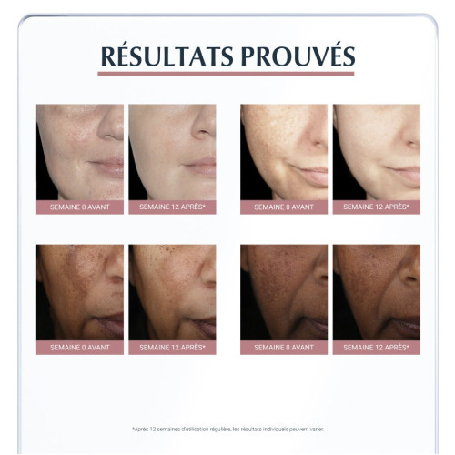 Eucerin Anti-Pigment Correcteur 5ml - Unifie Peau