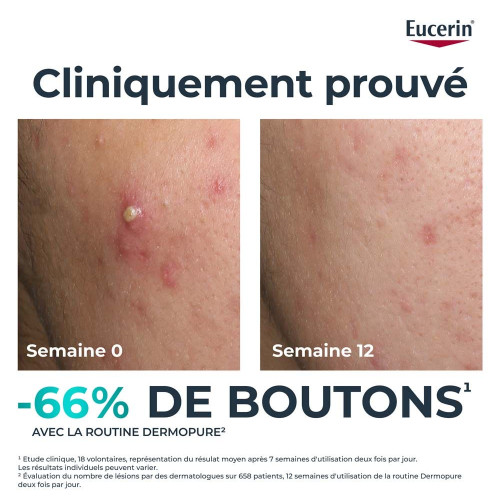 Eucerin DermoPure Sérum 40ml - Anti-marques et imperfections