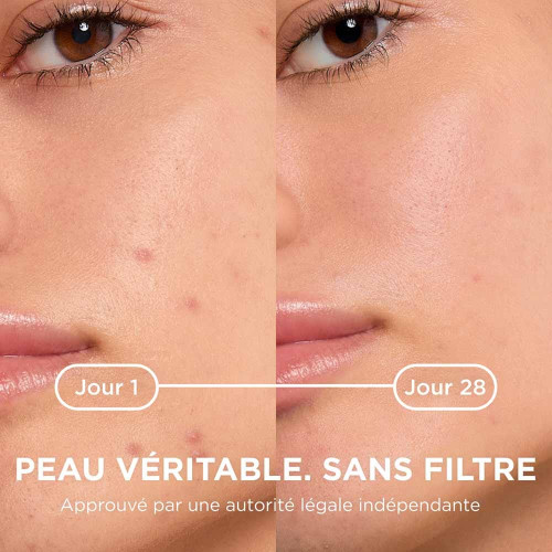 BIODERMA Sebium Kerato+ 30ml - Anti-imperfections, Peau Acnéique