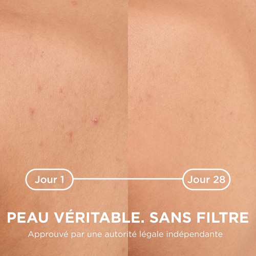 Bioderma Sébium Kerato+ Body 150 ml Spray Anti-Imperfections Efficace