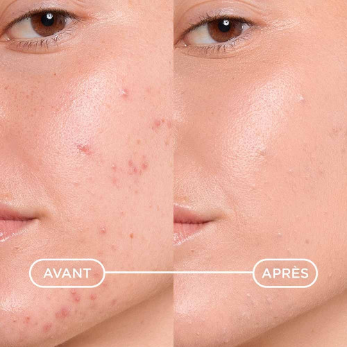 Bioderma Sébium Kerato+ Cover 30ml Teint Unifié Peau Sans Imperfections