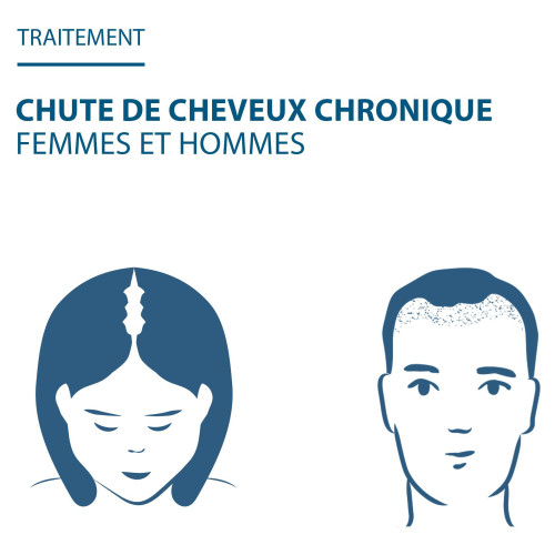 Ducray Anacaps Expert 90 Gélules - Stop Chute Cheveux