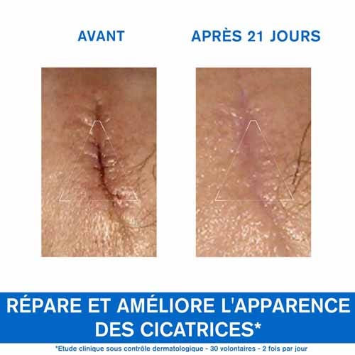 Uriage Bariéderm Cica-Crème 40ml - Apaise et Hydrate