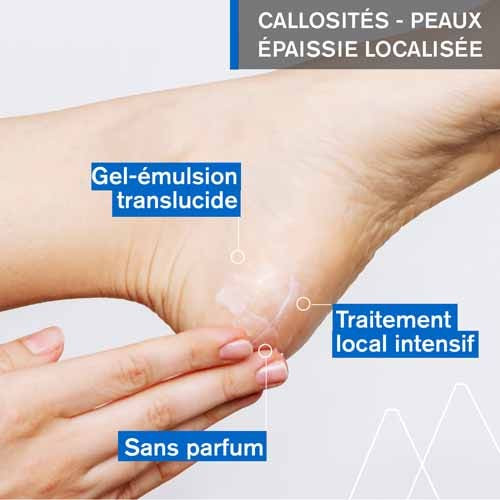 Uriage Kératosane 30 75ml - Soin Anti-Callosités Apaisant